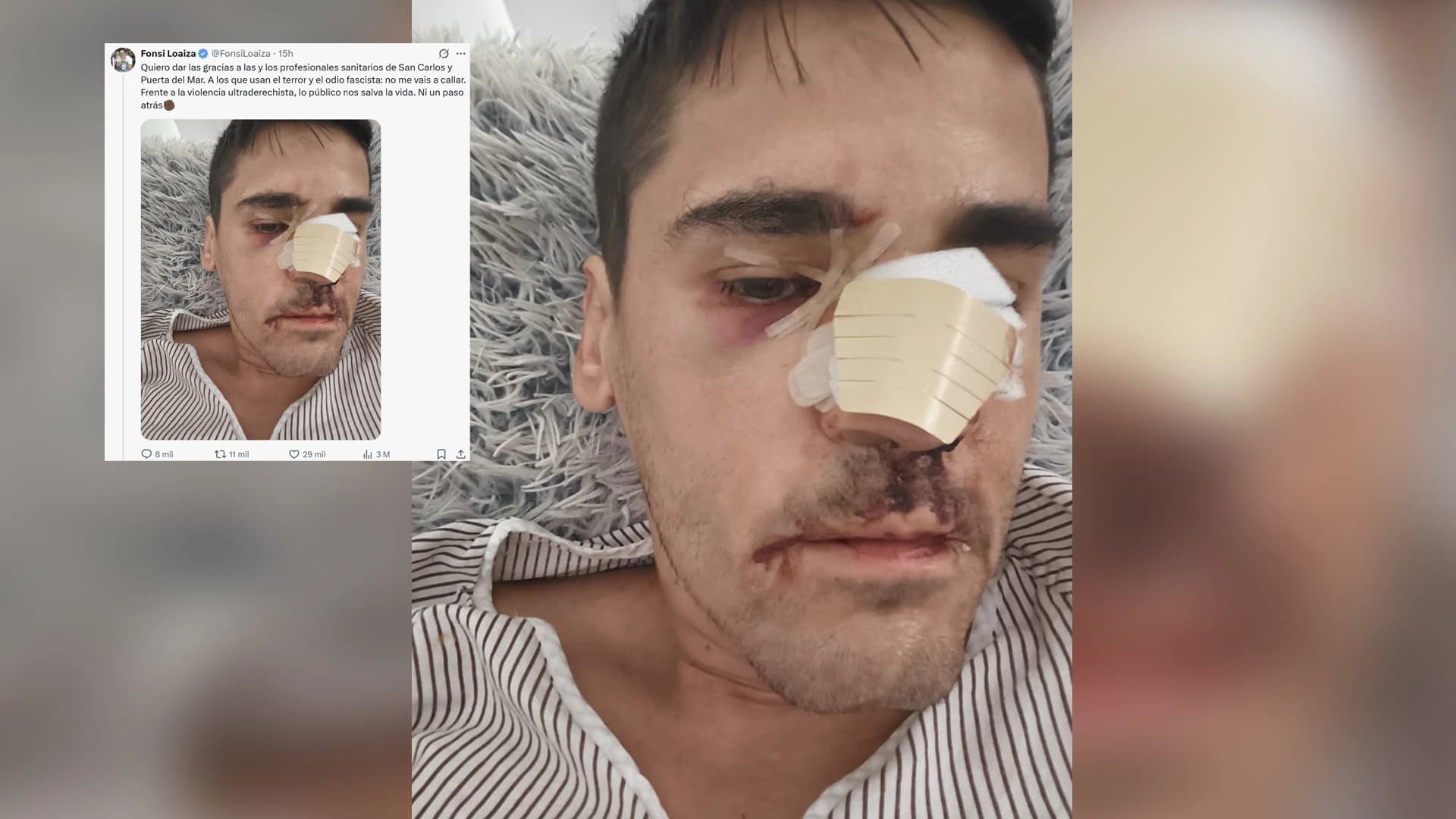 Vídeo: Fonsi Loaiza agredido, lo que no cuenta en su post de X
